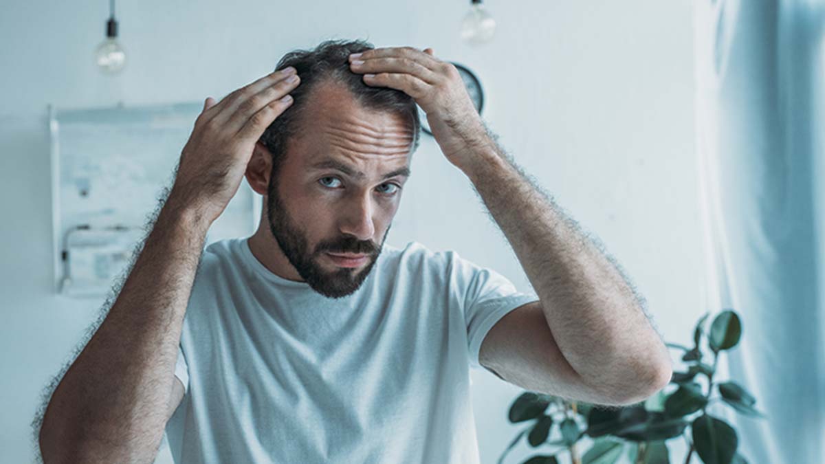 Homem a observar as entradas no cabelo